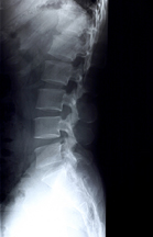 xray